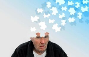 Read more about the article Alzheimer’s disease