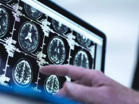 How Does Alcohol Affect and Damage your Brain