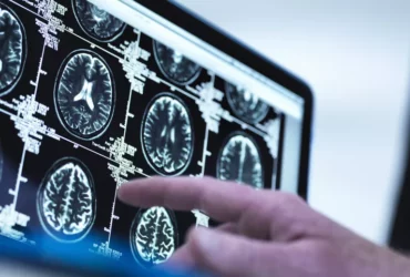 How Does Alcohol Affect and Damage your Brain