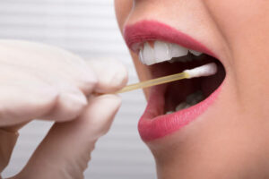 Read more about the article How Does a Mouth Swab Drug Test Work?