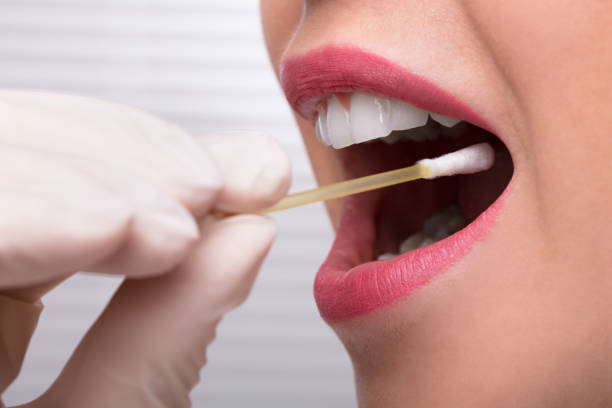 Read more about the article How Does a Mouth Swab Drug Test Work?