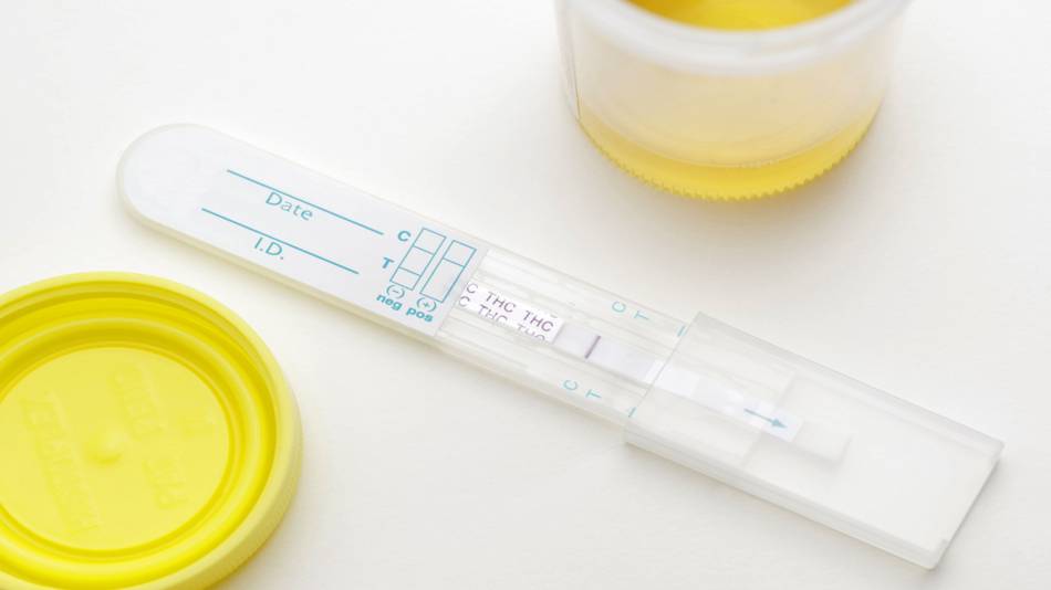 Read more about the article How do marijuana drug tests work?