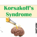 Wernicke–Korsakoff syndrome and alcohol