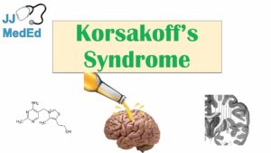 Read more about the article Wernicke–Korsakoff syndrome and alcohol