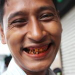 Addiction Chewing Betel Nut