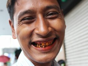 Addiction Chewing Betel Nut