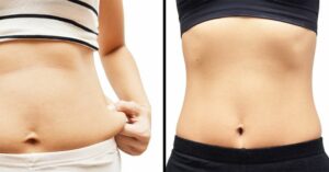 Read more about the article Tummy-tightening Exercises You Can Do in 10 Minutes