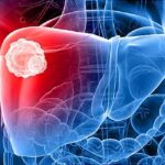 Your Liver Isn't As Strong as it