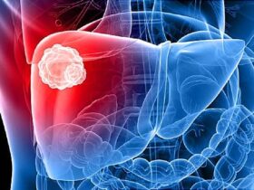 Your Liver Isn't As Strong as it