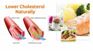 Read more about the article 7 Ways to Lower Your Cholesterol Naturally