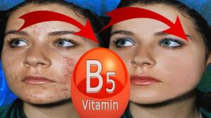 Lire la suite à propos de l’article 10 Bienfaits surprenant de la vitamine B5 pour la peau (acide pantothénique)