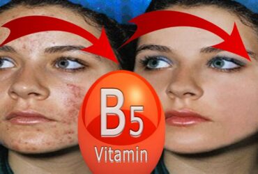 10 Surprising Benefits Of Vitamin B5 for Skin (Pantothenic Acid)