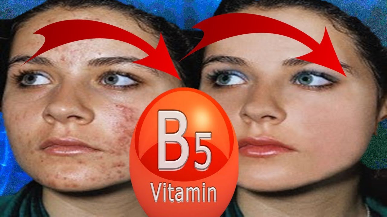 Read more about the article 10 Surprising Benefits Of Vitamin B5 for Skin (Pantothenic Acid)