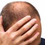 Does Hair Gel Cause Hair Loss Is Gel Good or Bad for Your Hair