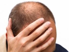 Does Hair Gel Cause Hair Loss Is Gel Good or Bad for Your Hair