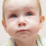 conjonctivite du bébé - traitement, symptômes et causes