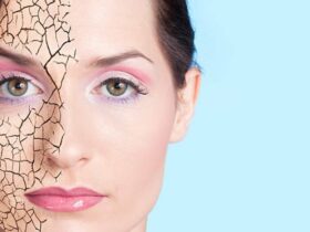 12 remèdes naturels contre la peau sèche que vous pouvez faits maison