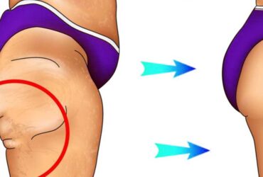comment perdre la graisse des cuisses  Essayez ces 7 exercices